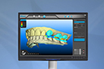 iTero® Scanner